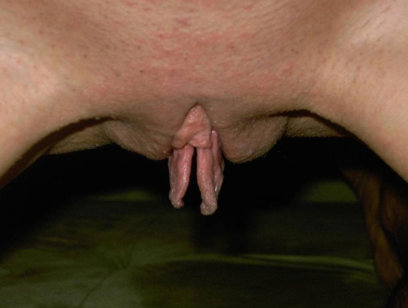 Huge female clitoris