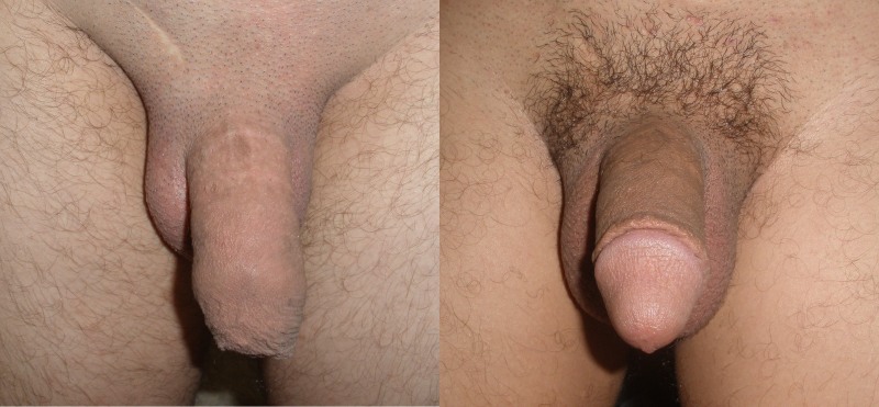 Natural unshaven blonde