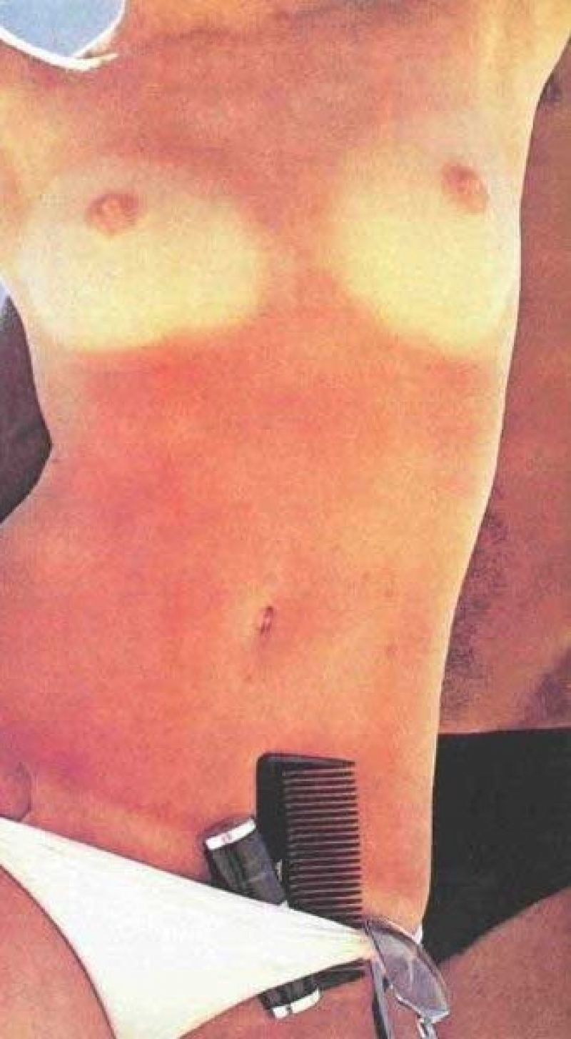 Angel Lynn Boris Nudozhnka