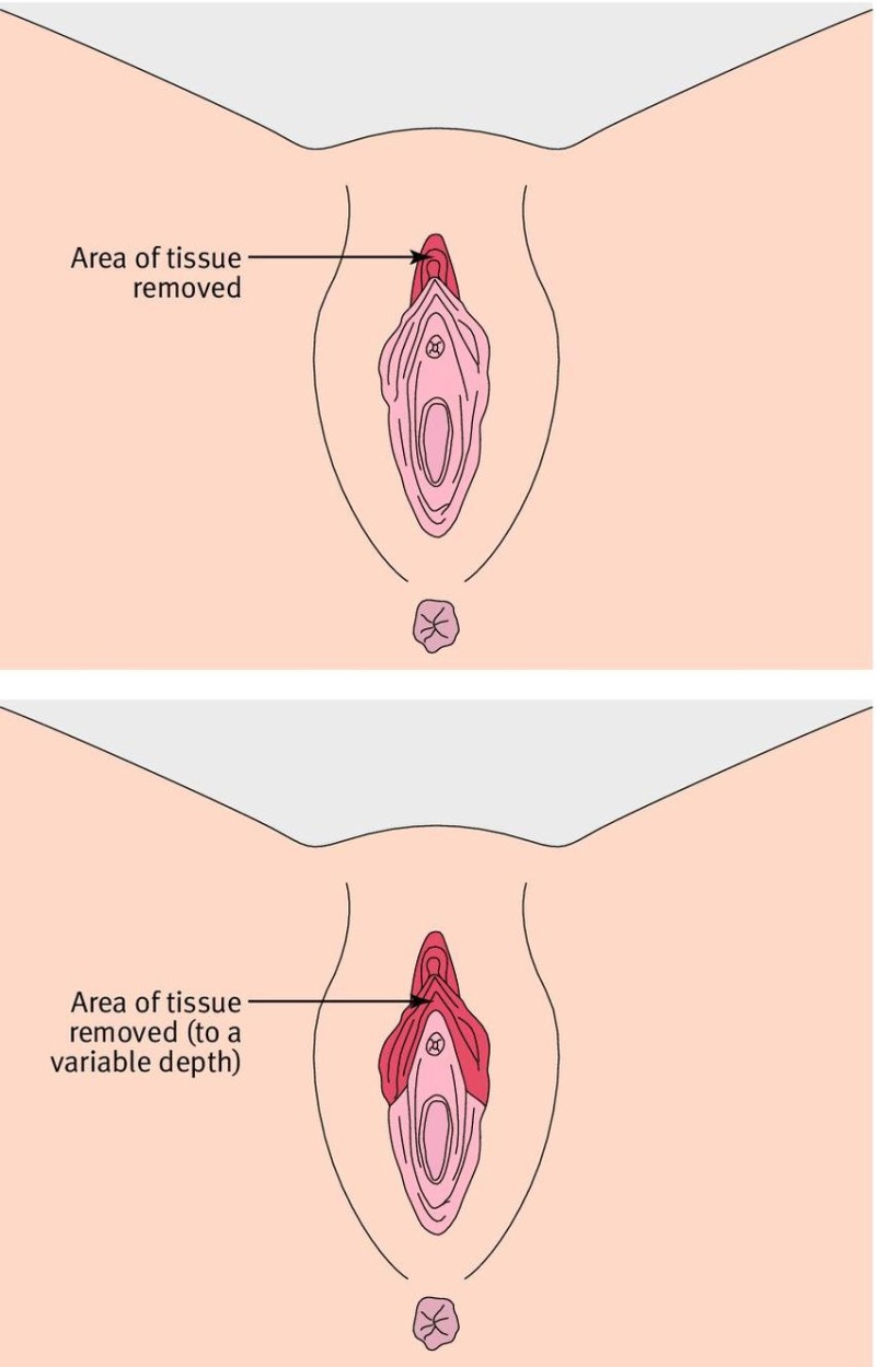 Genitals of men and women