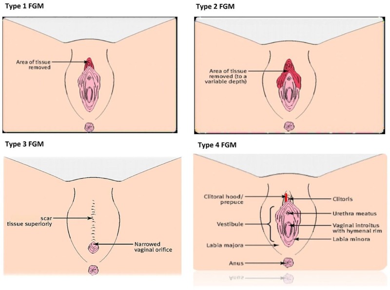 Masturbation Techniques: Circumcision Experience