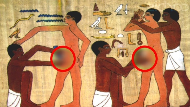 Surgery in ancient Egypt