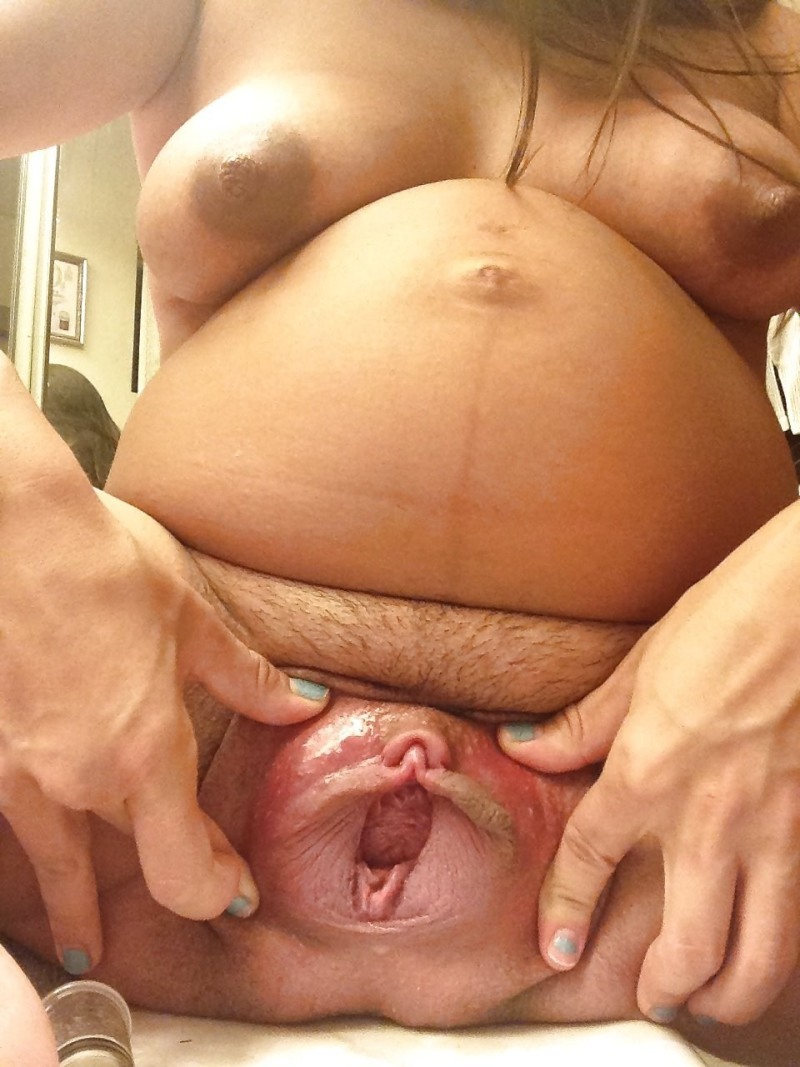 Pregnant vagina after childbirth
