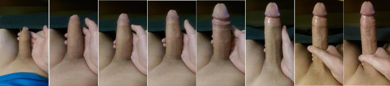 Cunnered penis erection