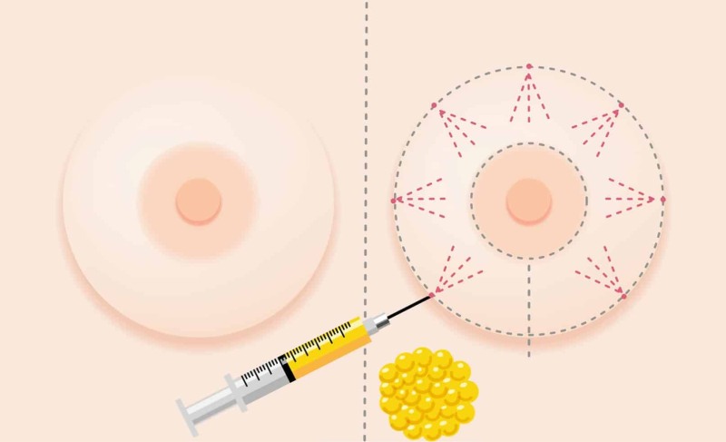 Drawing of female nipples