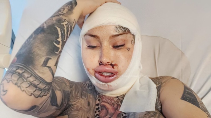 Simone Hanselmann Tits