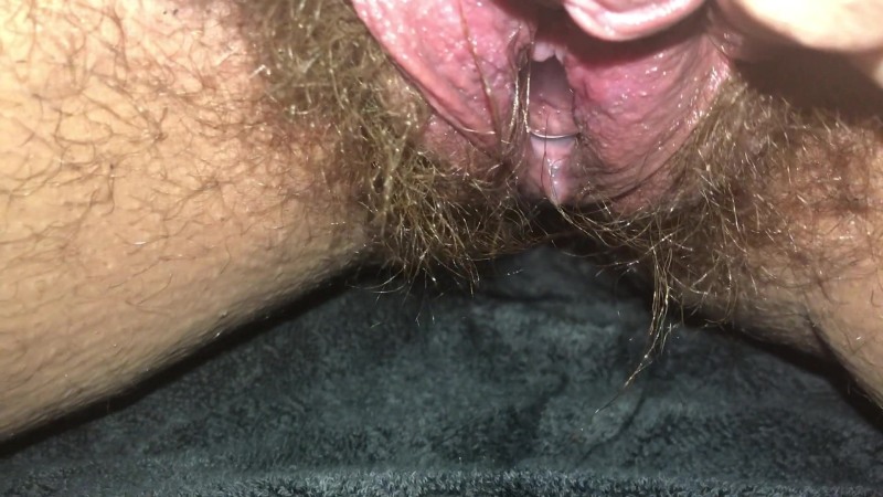 Terrible vaginas with pus