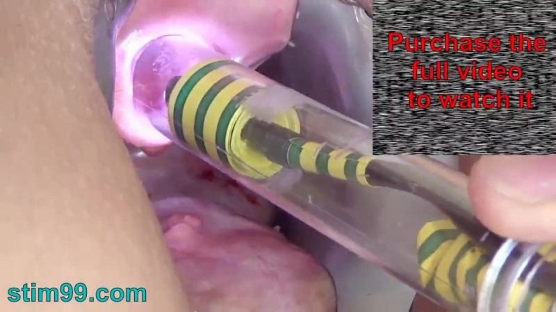 Catheterization of the bladder Equipment